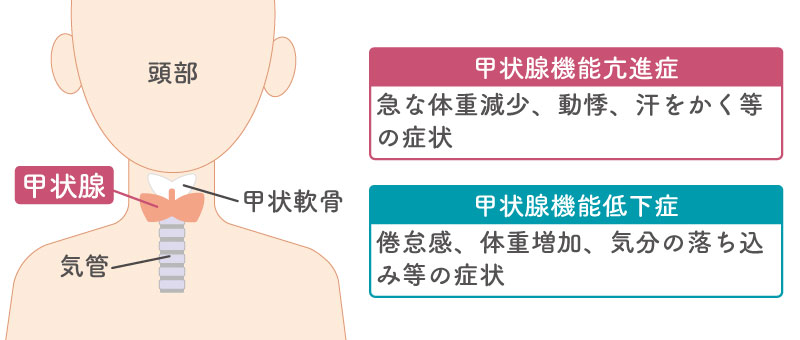 甲状腺の場所、甲状腺機能亢進症、甲状腺機能低下症